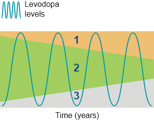 Chart illustrating the narrowing therapeutic window in PD